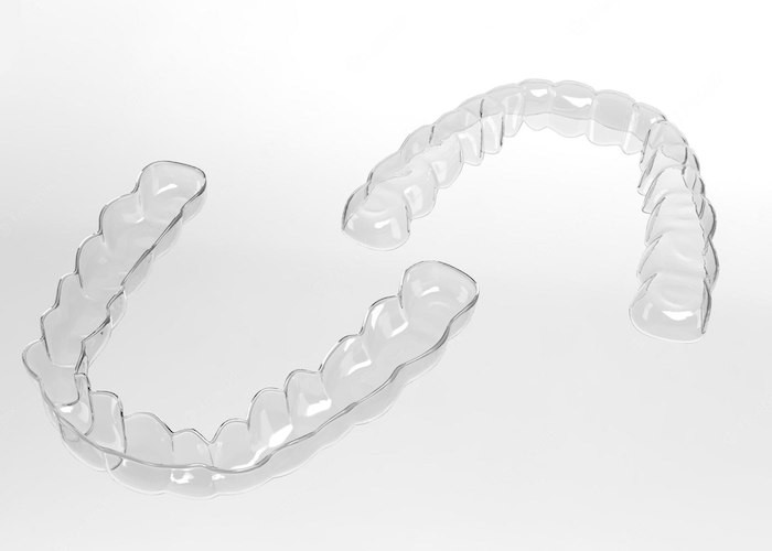 Questions sur Invisalign :leur coût, leur processus, etc. 