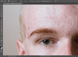 4 imperfections que vous pouvez facilement supprimer à l aide de Photoshop 