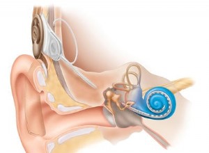 L implant rétablit l équilibre 