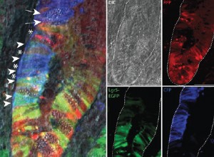 Les cellules souches cancéreuses stimulent la croissance tumorale 