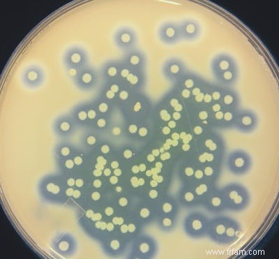 Liste et tromperie dans le biofilm 