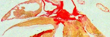 Inhiber la mort des cellules du muscle cardiaque 