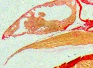 Inhiber la mort des cellules du muscle cardiaque 