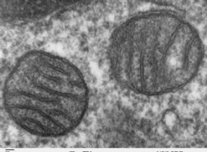 Un nouveau traitement pour la maladie de Parkinson en route 