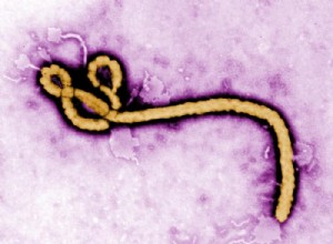 Ebola :un vaccin en vue ? 