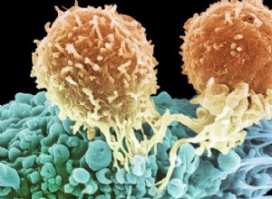 La thérapie par lymphocytes T gagne de plus en plus la bataille contre le cancer 