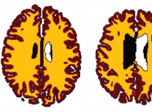 Les personnes obèses ont un cerveau plus âgé 