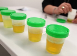 Votre urine révèle votre âge 