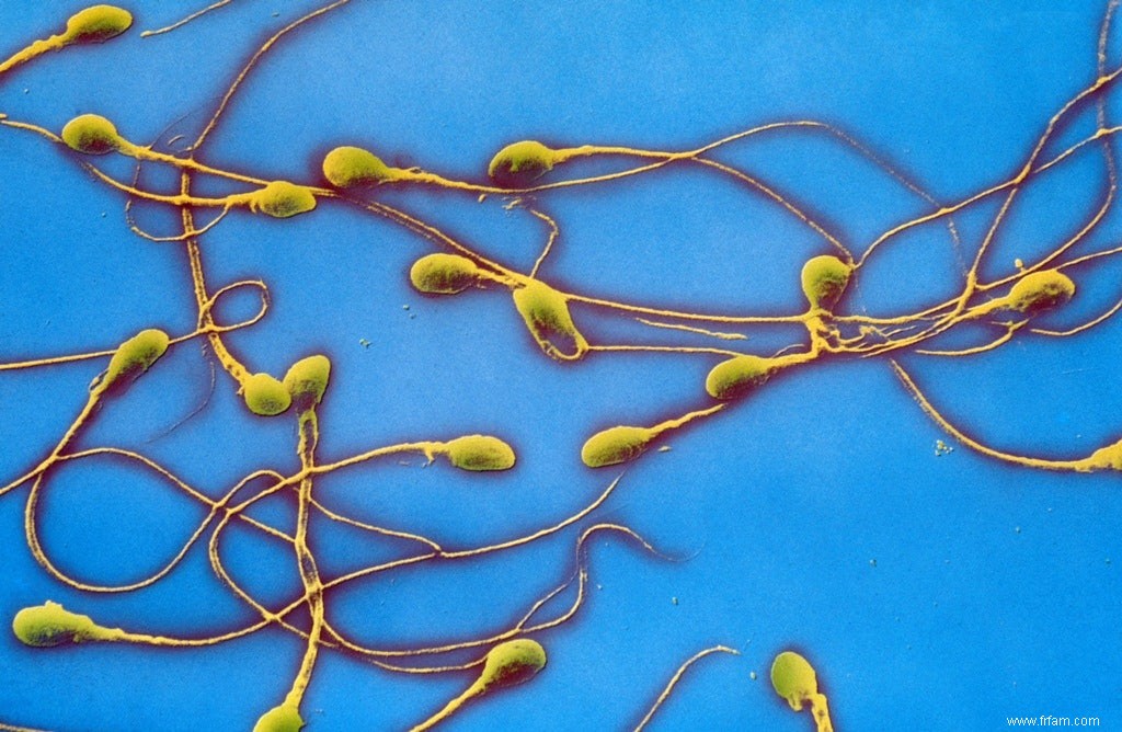 Un faible nombre de spermatozoïdes indique plus de problèmes que la simple infertilité 