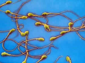 Un faible nombre de spermatozoïdes indique plus de problèmes que la simple infertilité 