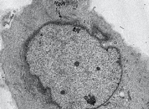 Le bouton d autodestruction de la cellule 