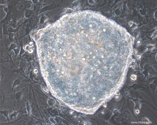 Cellules réinitialisées en cellules souches dans un organisme vivant 