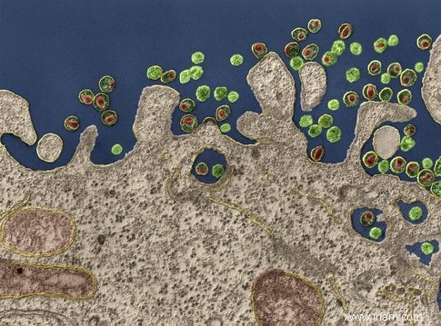 L arme du VIH tue les cellules infectées 