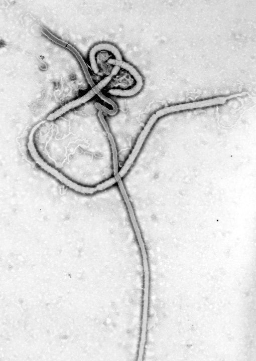 Le virus Ebola vieux de 20 millions d années 