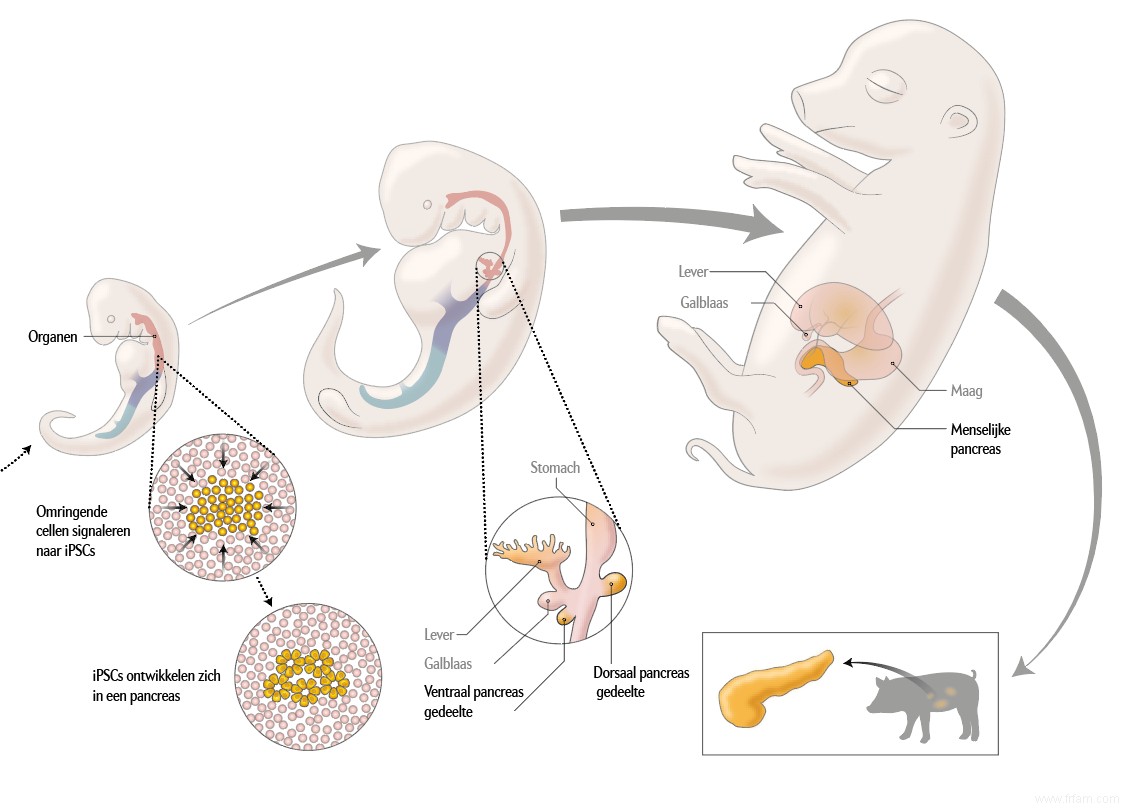 Voici comment vous faites pousser des organes humains chez un cochon 