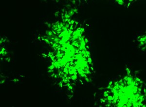 Les bactéries se protègent depuis un certain temps avec Crispr 