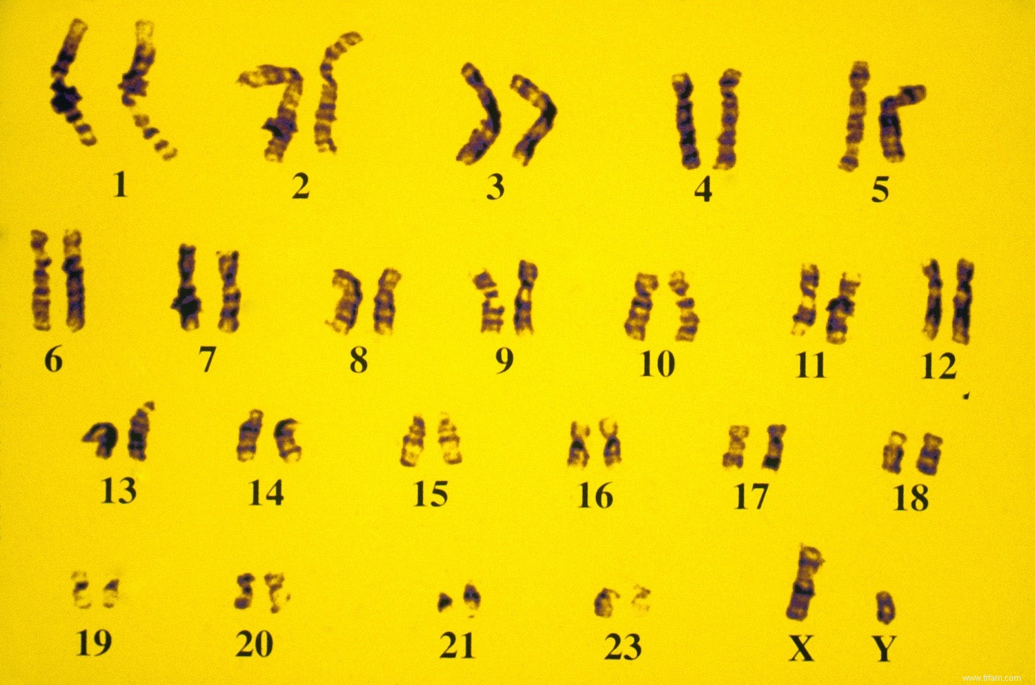 Comment détecte-t-on les variants dans l ADN ? 