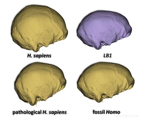 Homo floresiensis alors une espèce humaine à part entière 