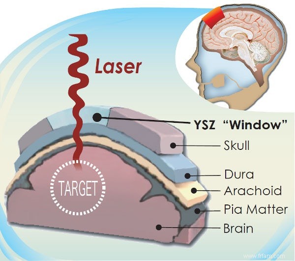 Une fenêtre permanente sur le cerveau 