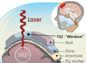 Une fenêtre permanente sur le cerveau 