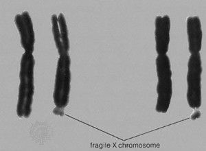 Un mécanisme à l origine de l autisme, de la schizophrénie et de la maladie d Alzheimer 