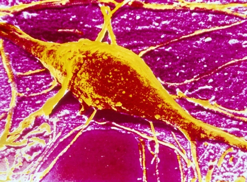 Le stress bloque la production de cellules cérébrales 