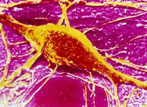 Le stress bloque la production de cellules cérébrales 