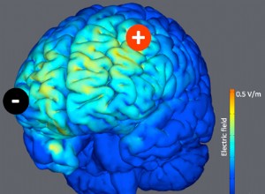 L électrostimulation  réveille  le cerveau des patients dans le coma 