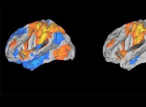 La douleur chronique modifie le cerveau 