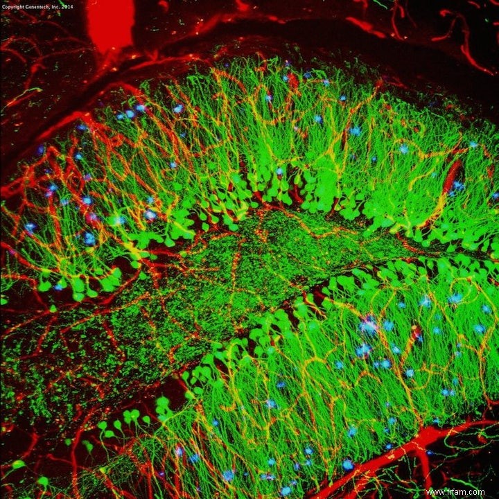 Les médicaments contre la maladie d Alzheimer fonctionnent chez les singes 