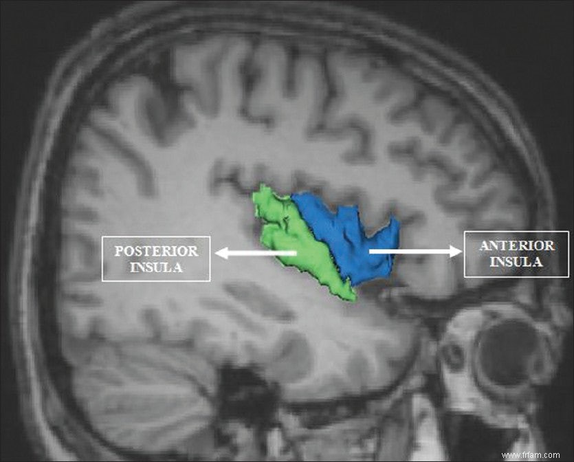 Douleur à lire dans le cerveau 