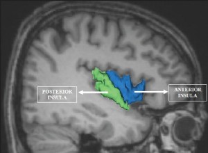 Douleur à lire dans le cerveau 