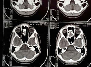 Que font les variations génétiques sur notre cerveau ? 