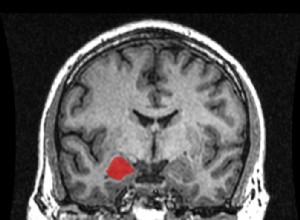 Comment le cerveau nous fait peur 