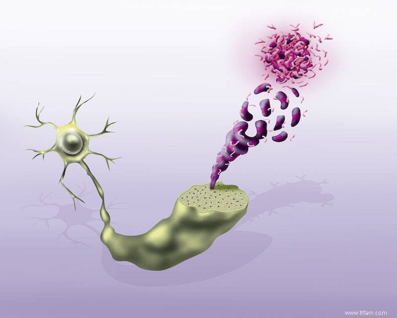 La protéine d Alzheimer chez un quinquagénaire sur dix 