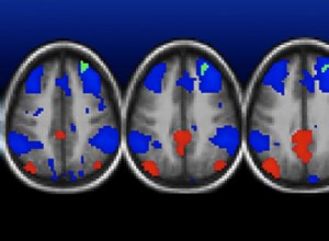 La pauvreté se voit dans le cerveau 