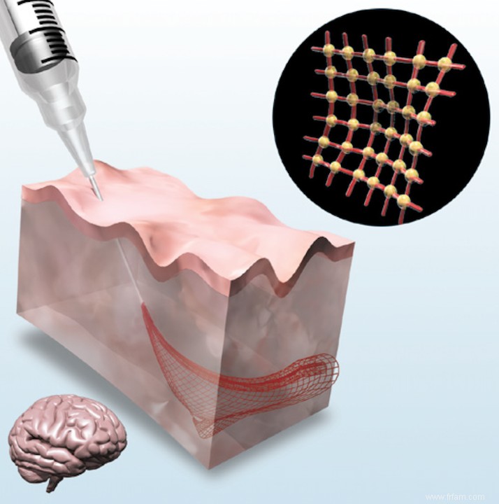 Sondes électroniques douces pour le cerveau 