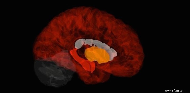 Un nouveau regard sur la maladie d Alzheimer 