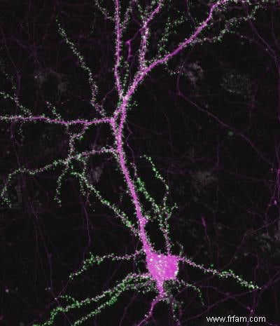 Les synapses jouent un rôle crucial dans la propagation de la maladie d Alzheimer 