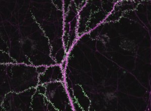 Les synapses jouent un rôle crucial dans la propagation de la maladie d Alzheimer 