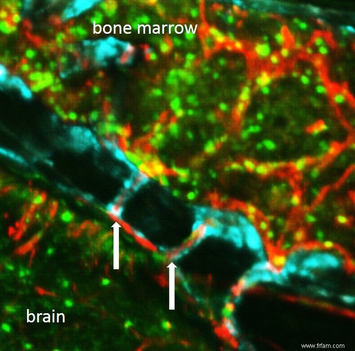 Les cellules immunitaires atteignent le cerveau par de petits tunnels dans notre crâne 