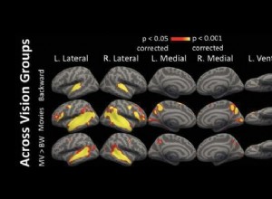 Les personnes aveugles utilisent le cortex visuel pour écouter 