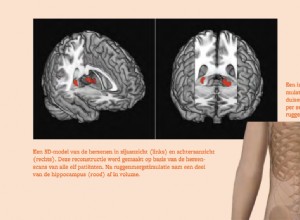 Le cerveau comme médicament contre le mal de dos 