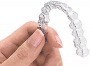 Obtenez ce sourire parfait :éléments clés à savoir avant d obtenir un Invisalign 