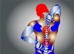 Quelles sont les meilleures options de traitement de la sciatique ? 