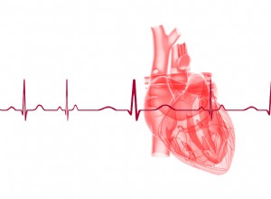 Prendre soin des patients atteints de troubles du rythme cardiaque :ce que vous devez savoir 